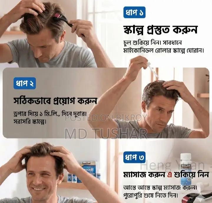 Minoxidil 5%