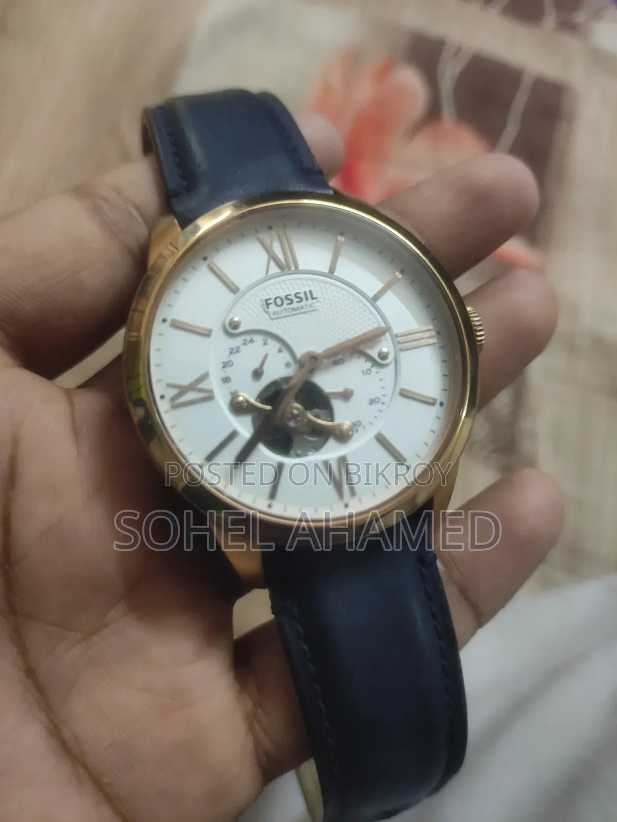 ফ্রেস কন্ডিশন