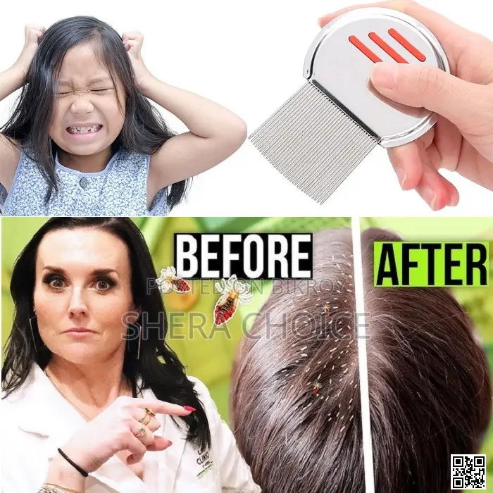 Stainless Steel Lice Removal Comb