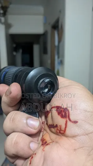 Mobile Zoom Lens