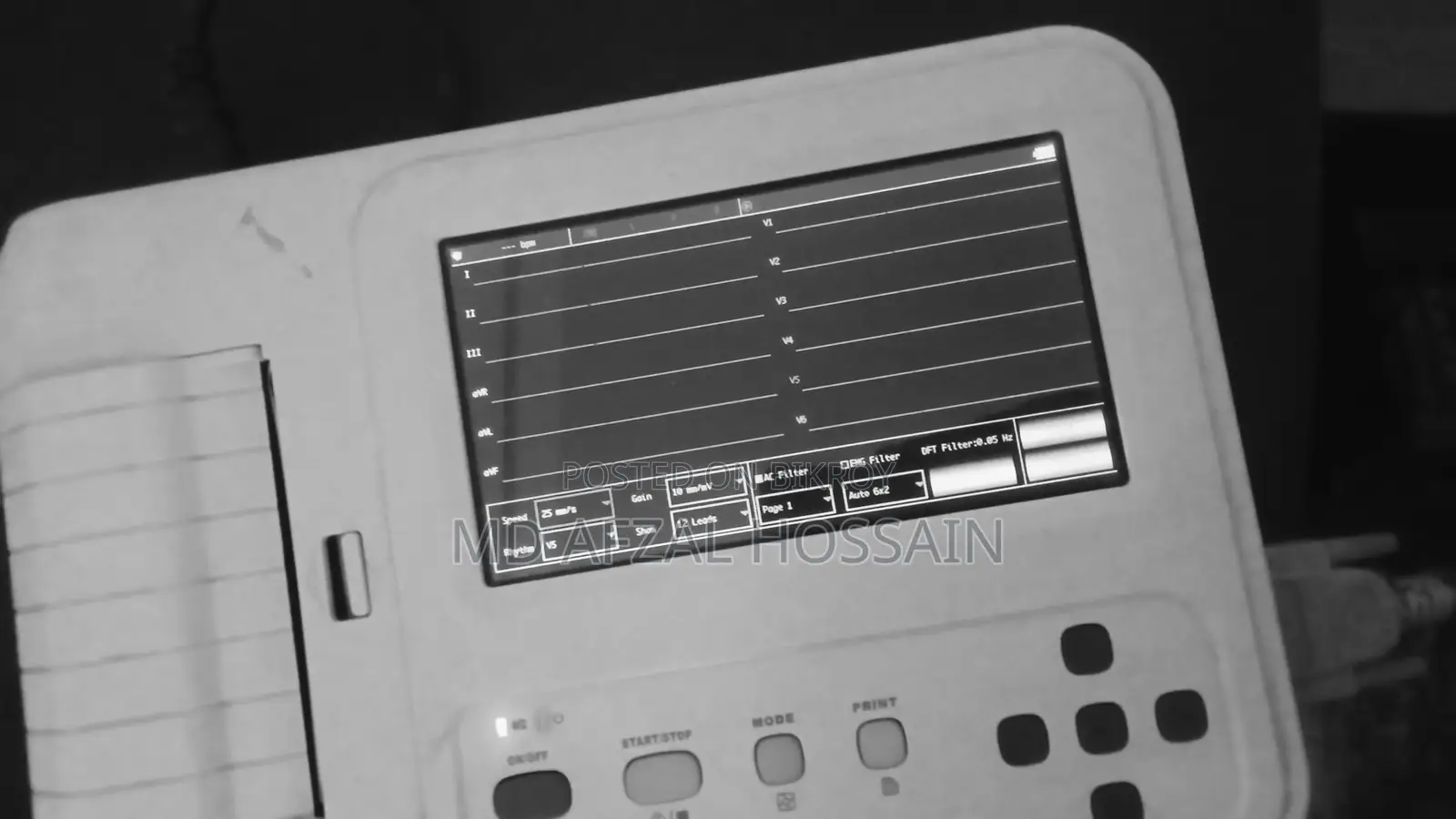 ECG Machine for Sale