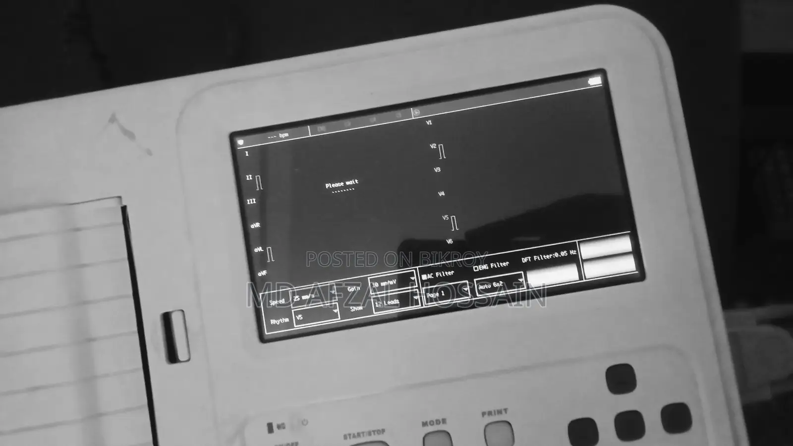 ECG Machine for Sale
