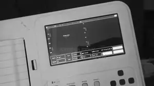 ECG Machine for Sale