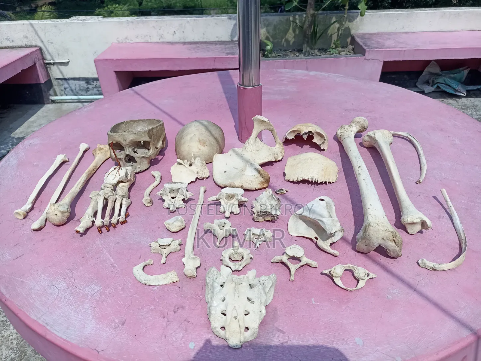মেডিকেল হাফ সেট বোনস