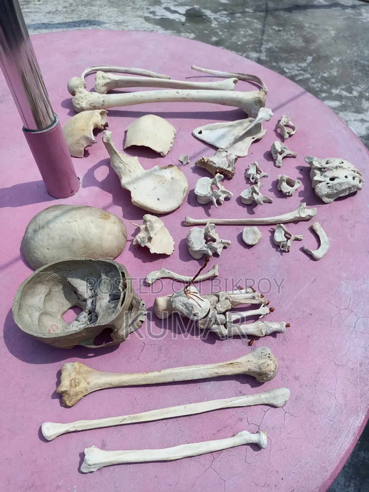 মেডিকেল হাফ সেট বোনস