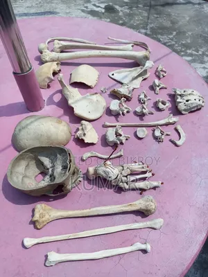 মেডিকেল হাফ সেট বোনস
