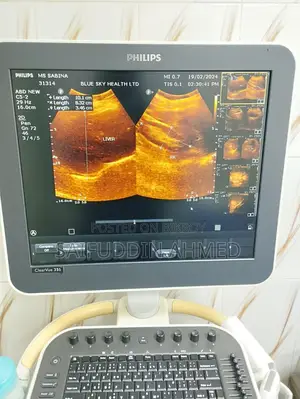 আল্ট্রাসাউন্ড মেশিন