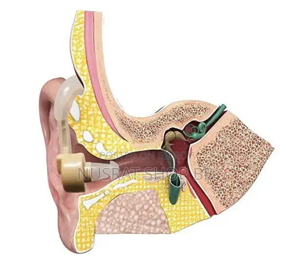 (R)Cyber Sonic Hearing Aid