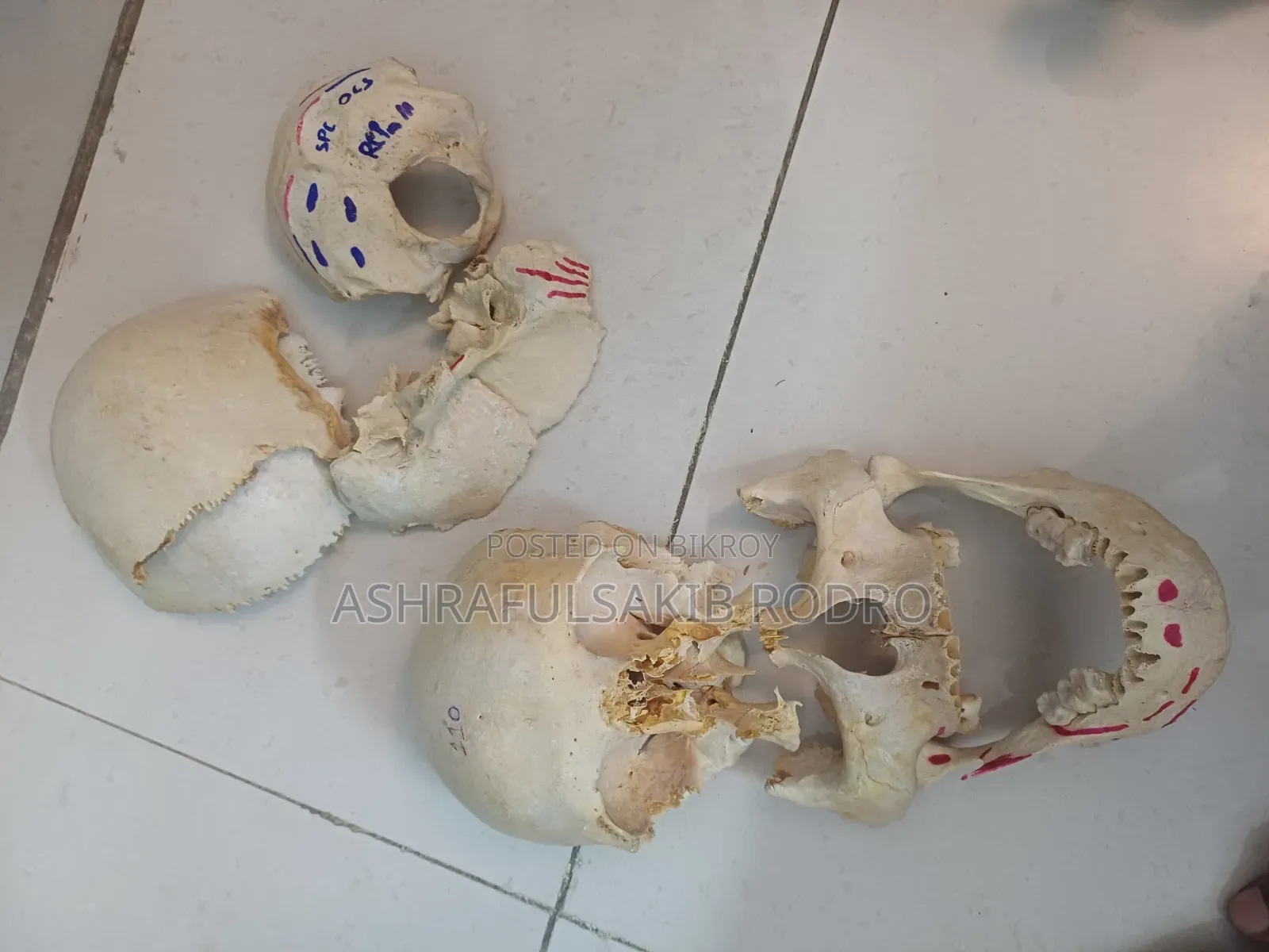 Medical Bones Set