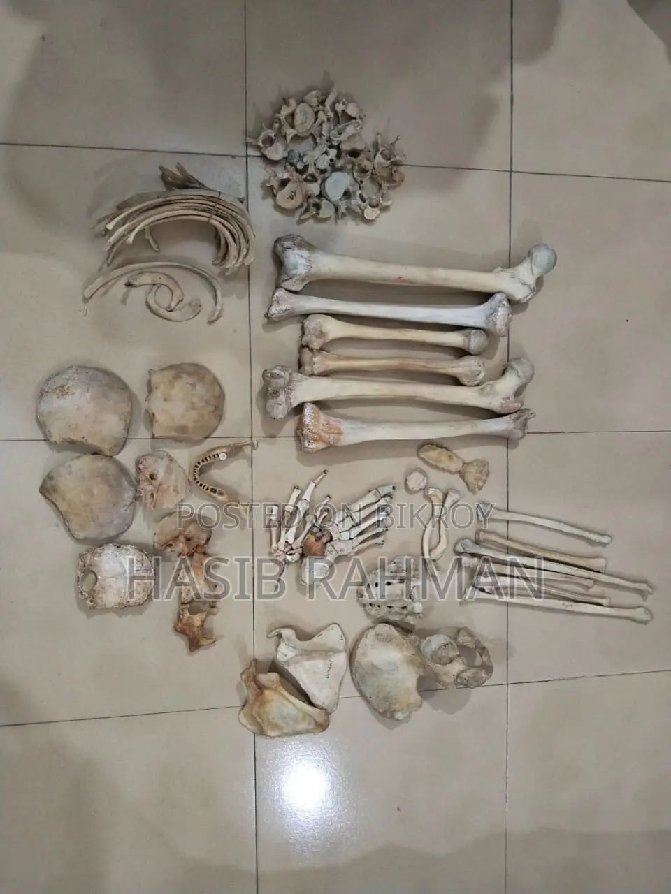 Human Skeleton for Medical Users