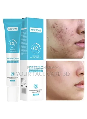 Mooyam Acne Remove Gel
