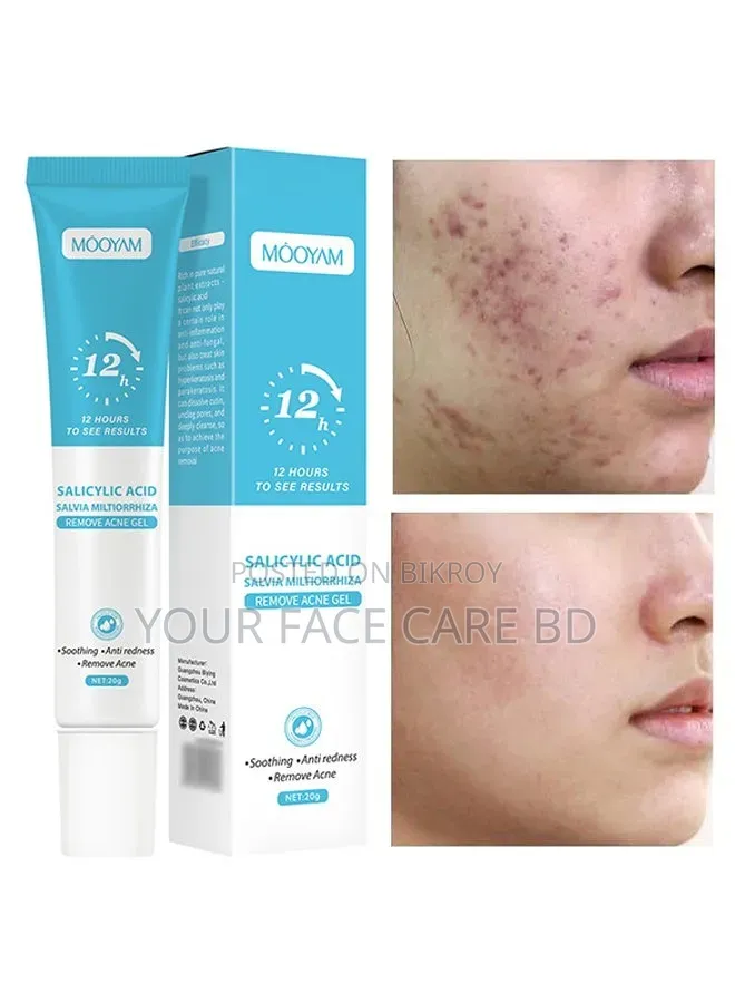 Mooyam Acne Remove Gel