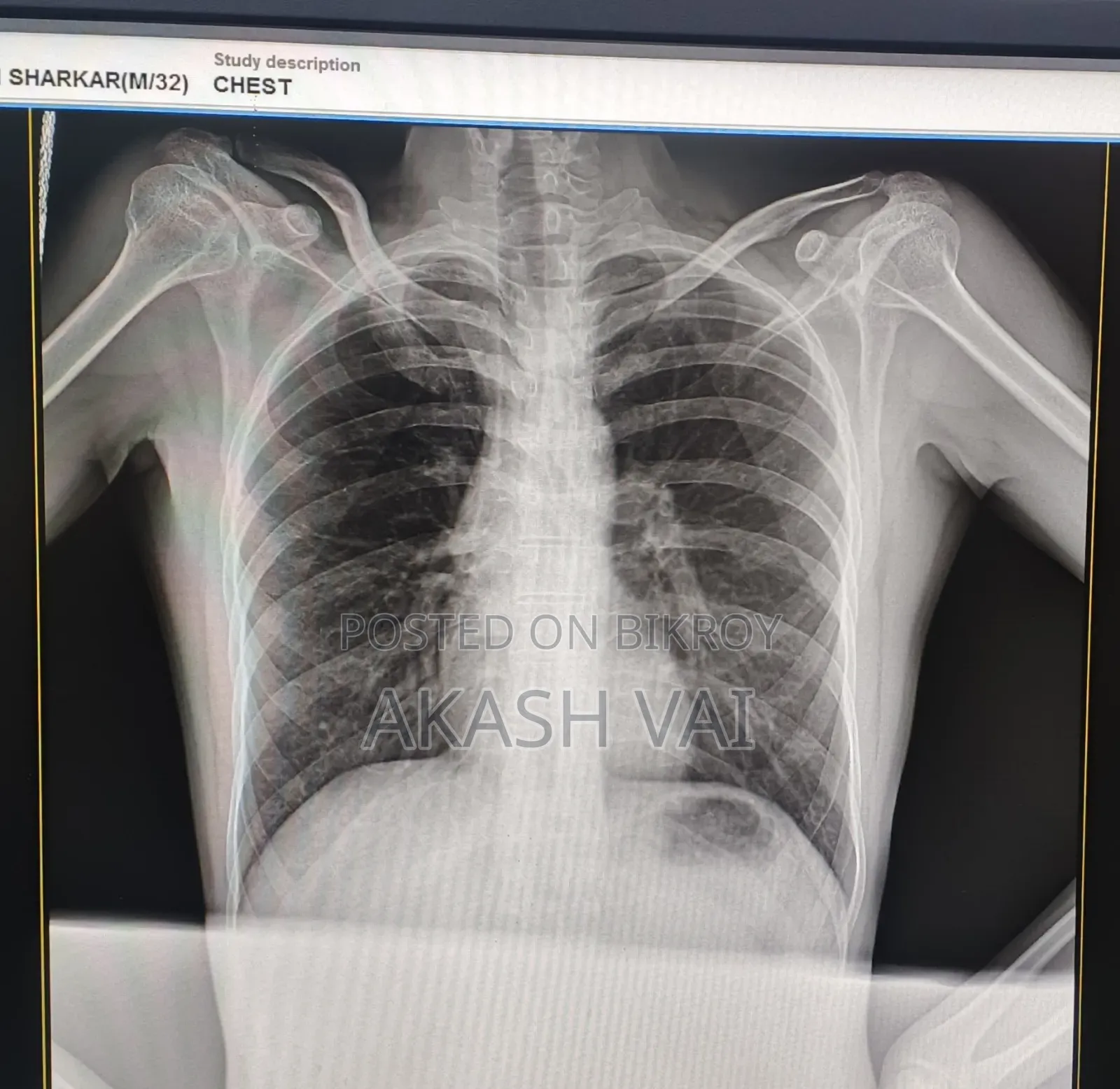 X-ray Machine