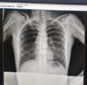 X-ray Machine