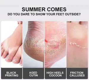 Complete Foot Care Foot Peel Mask – Order Now!