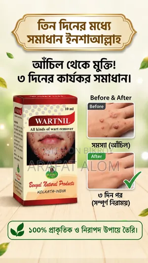 Three-day solution free from warts