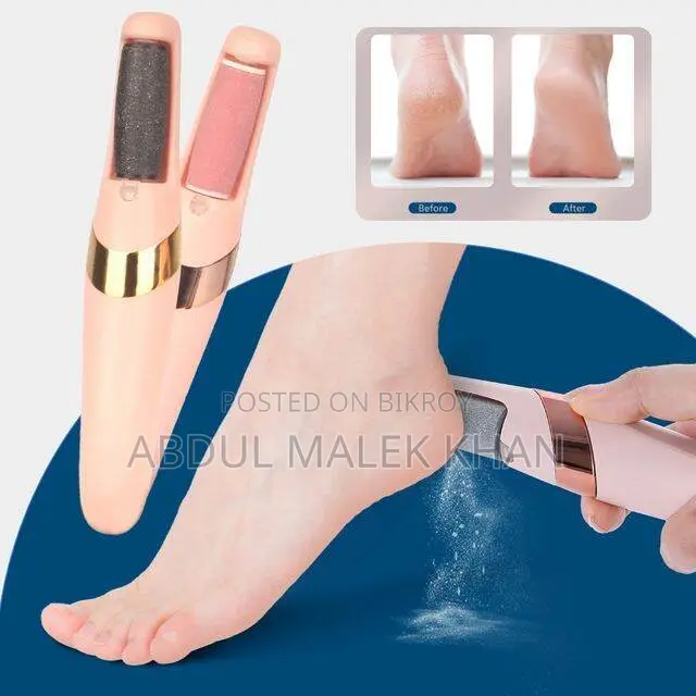 Electric Foot Callus Remover Foot File for Dead Hard Cracked Dry Skin 