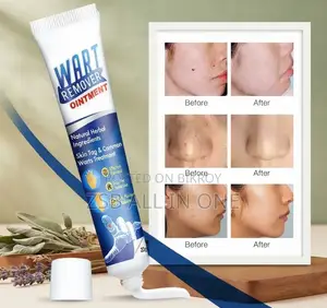 Wart Remover Ointment Best Product