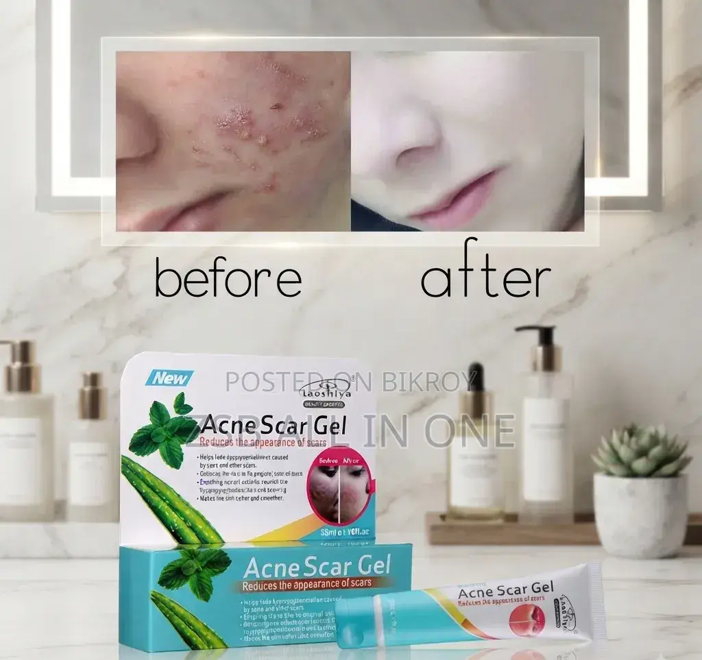 Acne Scar Gel – Care to Reduce Acne Scars