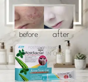 Acne Scar Gel – Care to Reduce Acne Scars