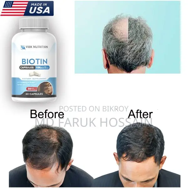 Biotin Advanced Hair Growth Formula (Made in USA)