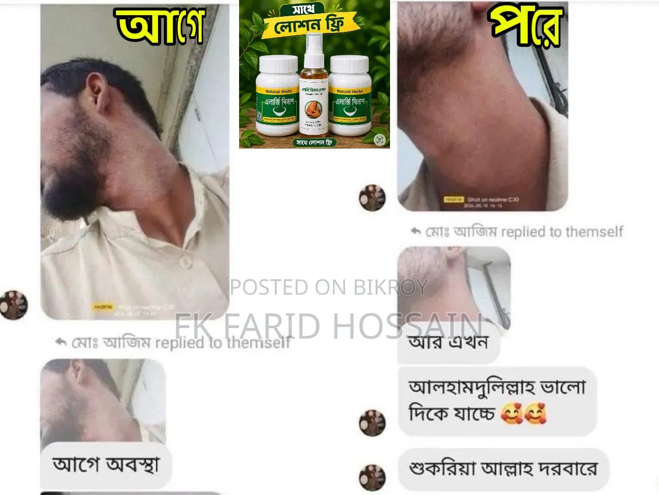 এলার্জি বিনাশ