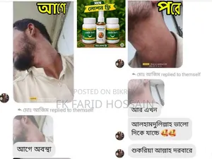 এলার্জি বিনাশ