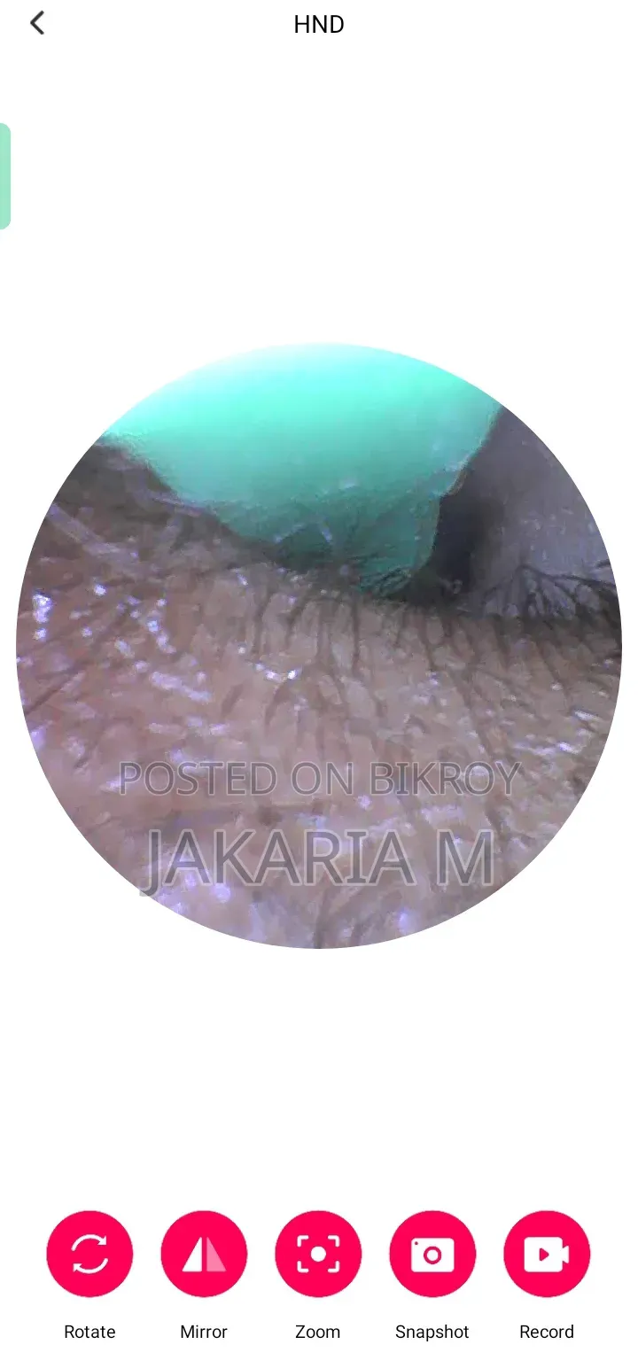 Wireless Visual Earpick