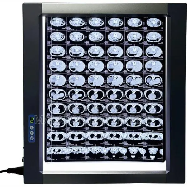 Easywell MST-4000II Double Panel LED X-ray Viewer
