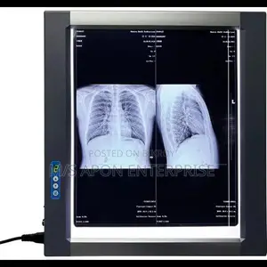 Easywell MST-4000I Single Panel LED X-ray Viewer