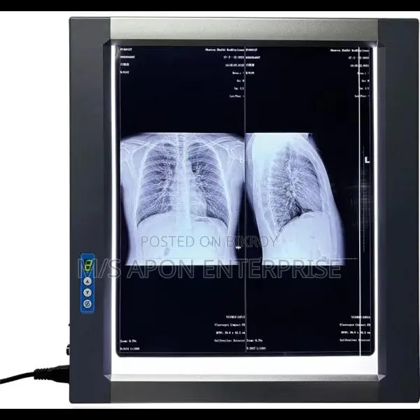 Easywell MST-4000I Single Panel LED X-ray Viewer