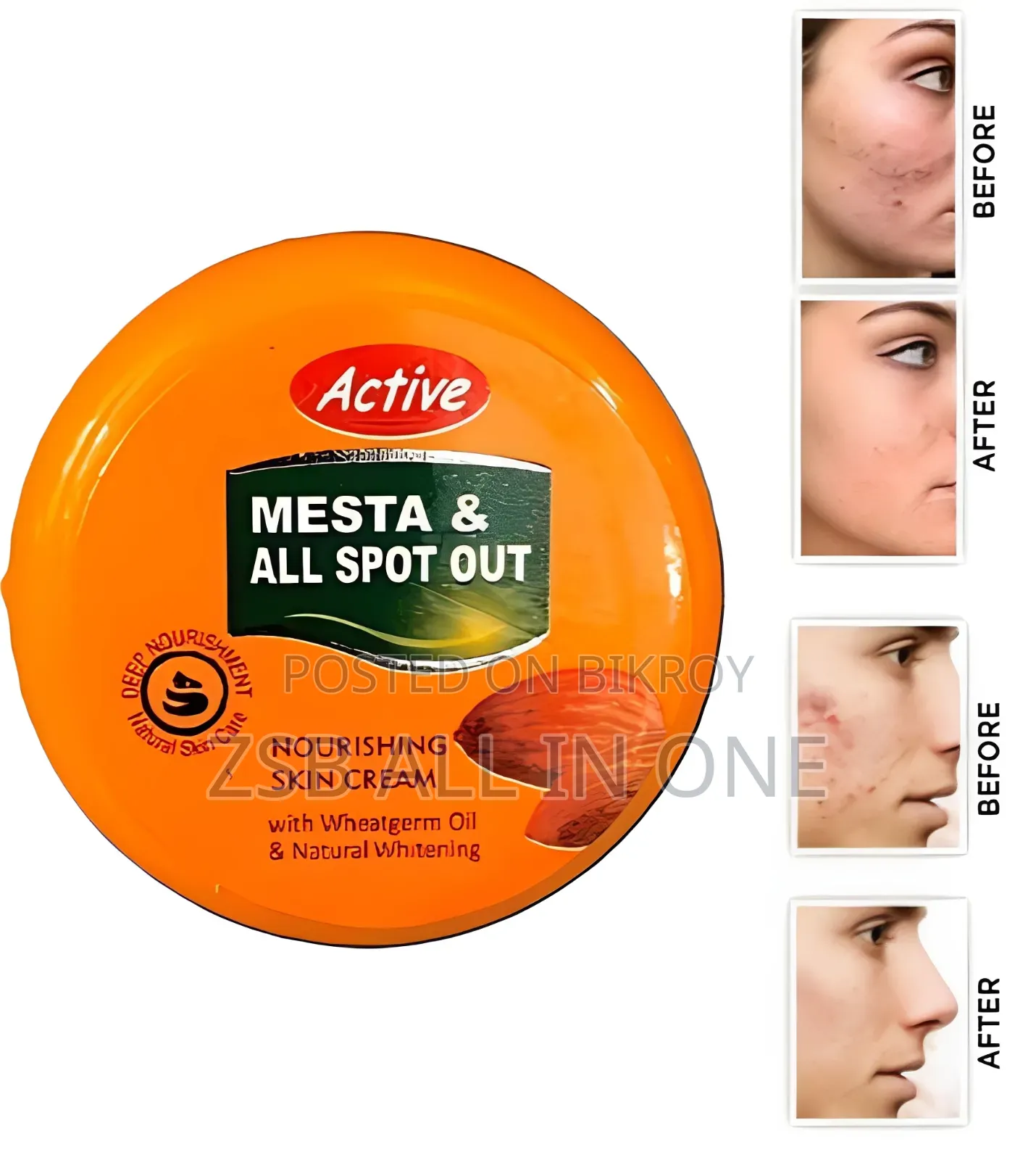 Active Mesta and All Spot Out Nourishing Skin Cream