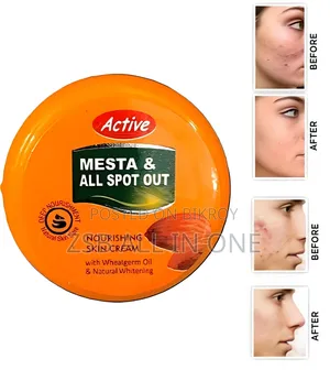 Active Mesta and All Spot Out Nourishing Skin Cream