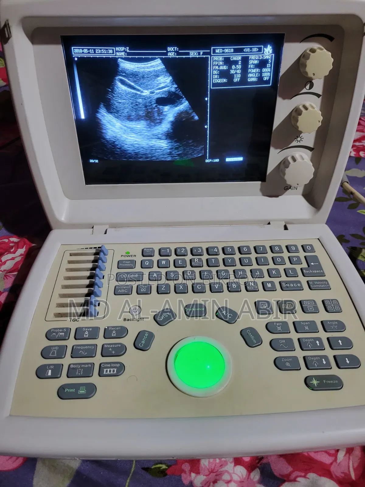 Ultrasound Machine