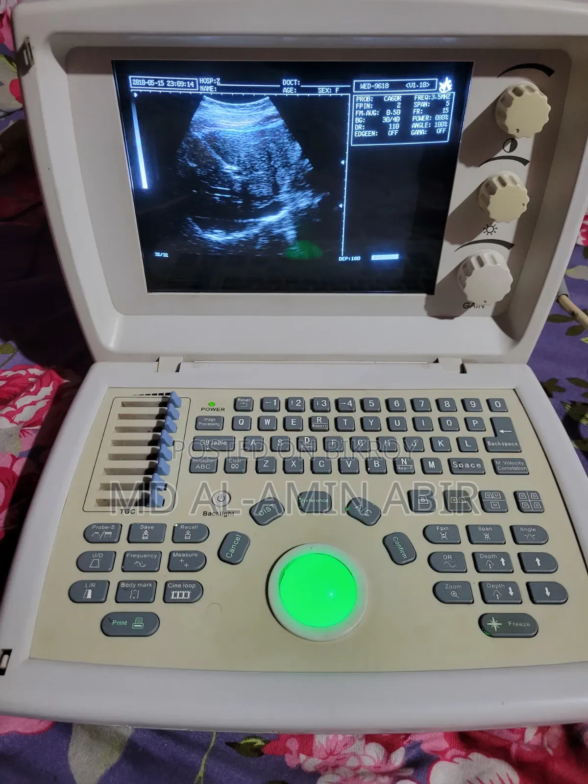 Ultrasound Machine
