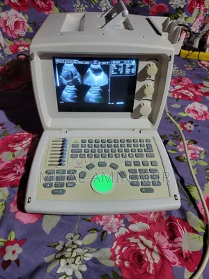 Ultrasound Machine