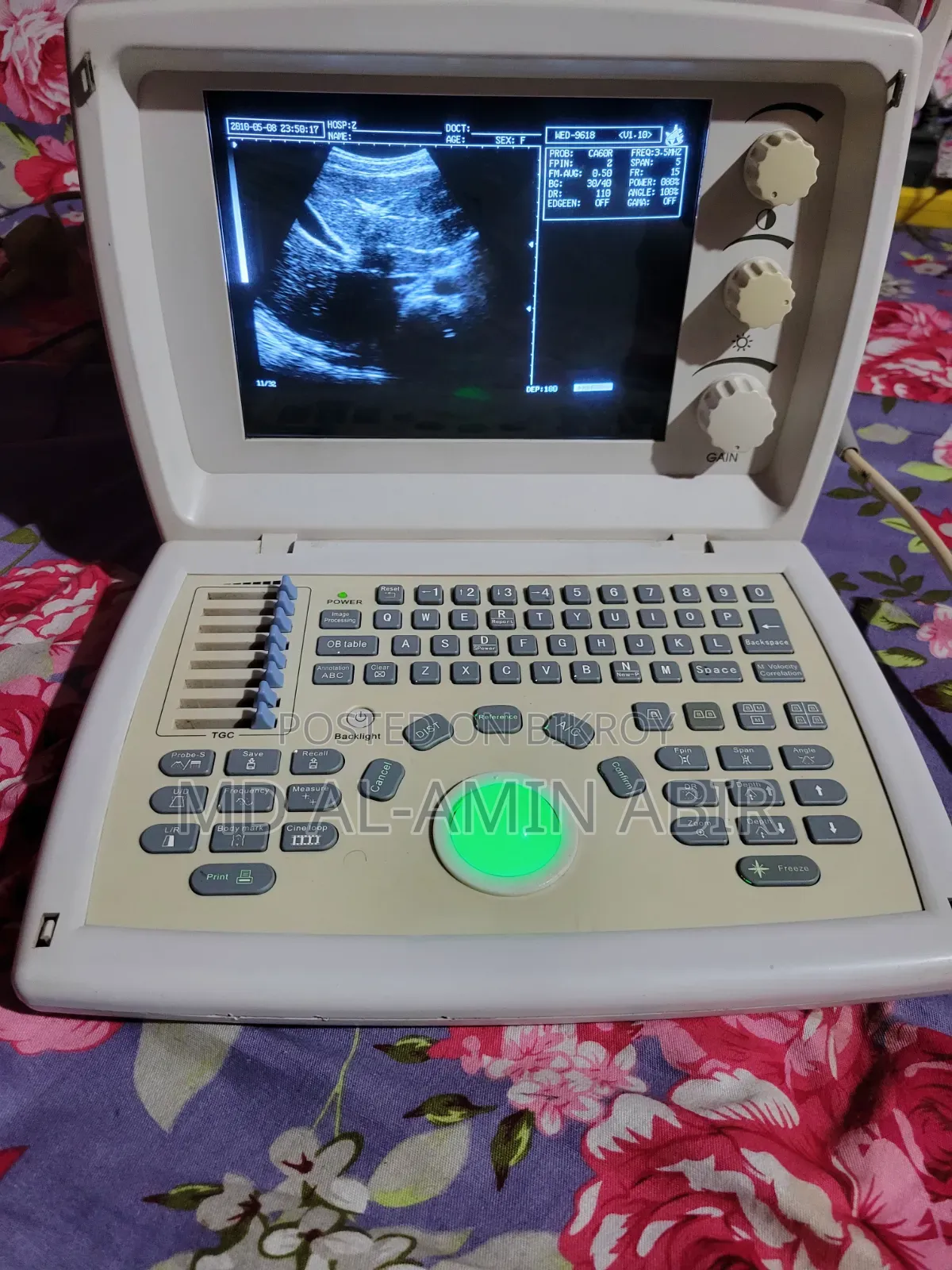 Ultrasound Machine