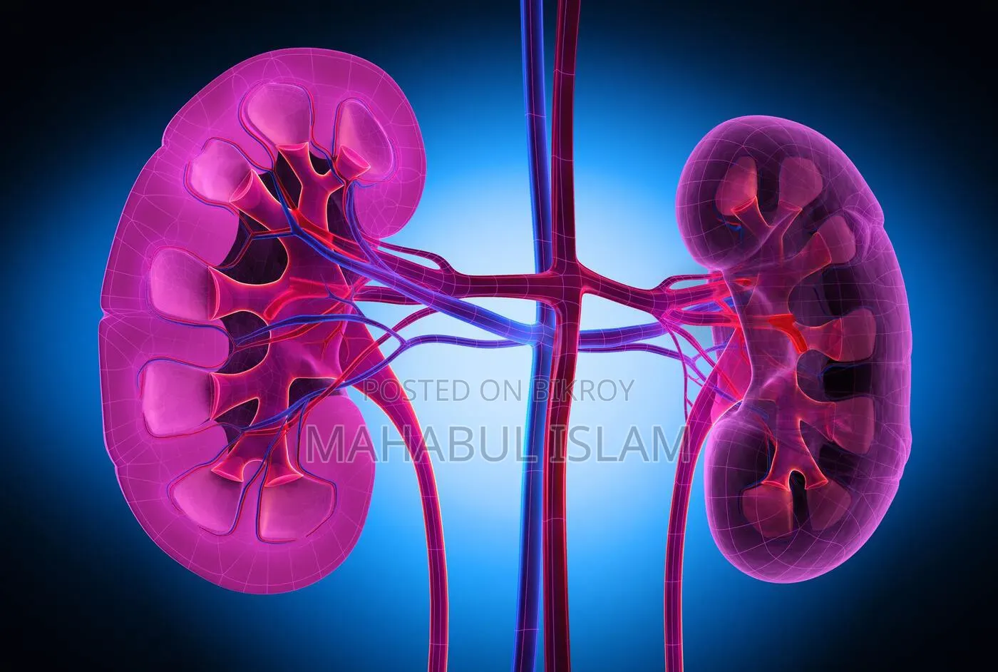 Kidney Sell Post