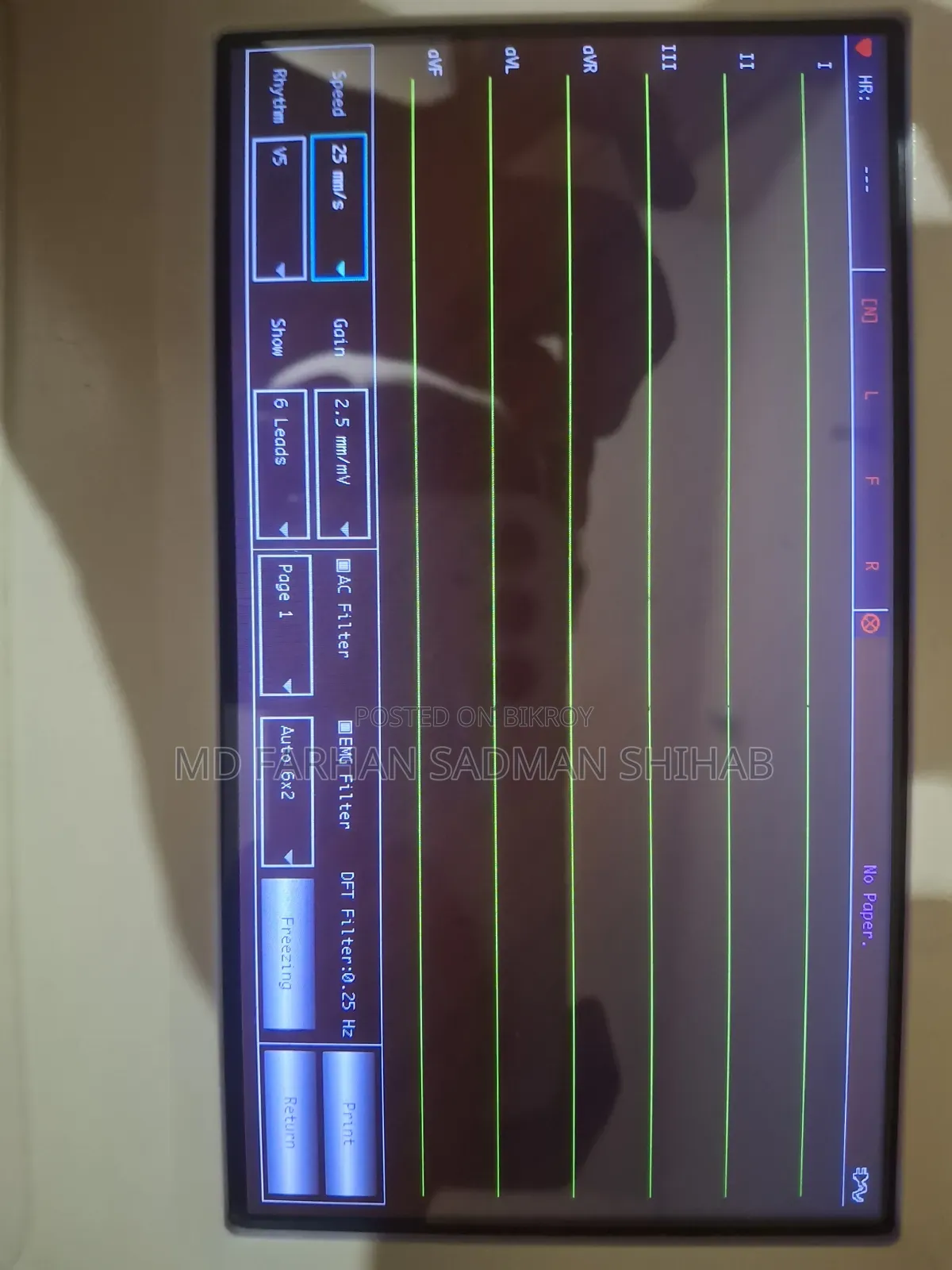 Ecg Machine