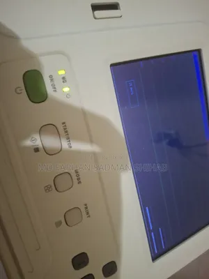 Ecg Machine