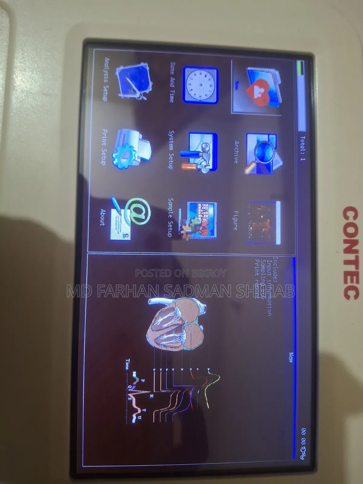 Ecg Machine