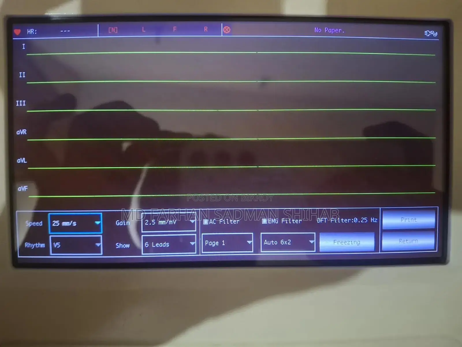 ECG Machine