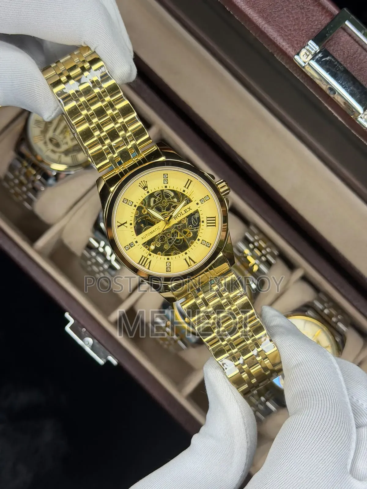 Premium Watch Connection All Over Bangladesh Home Delivery