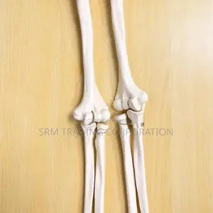 XC-121 Life Size Upper Limb Skeleton Model
